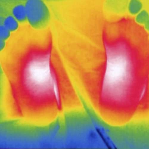 thermal-clinicgram Clinicgram|Products