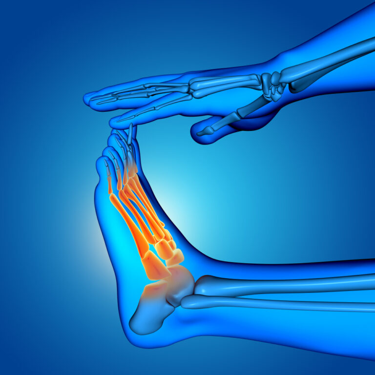Clinicgram|Wound Risk Assessment Before They Appear: Is It Possible?