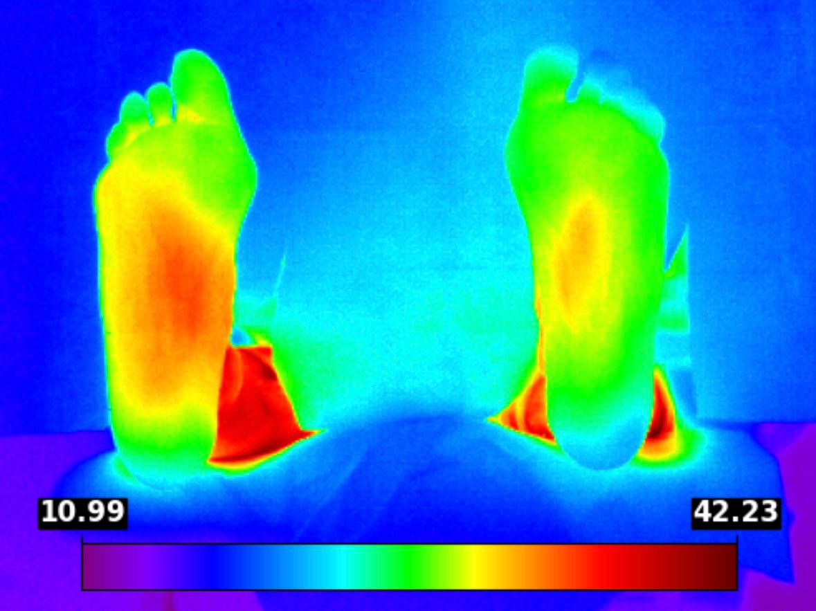 Clinicgram | Benefits of Early Detection in Diabetic Foot 