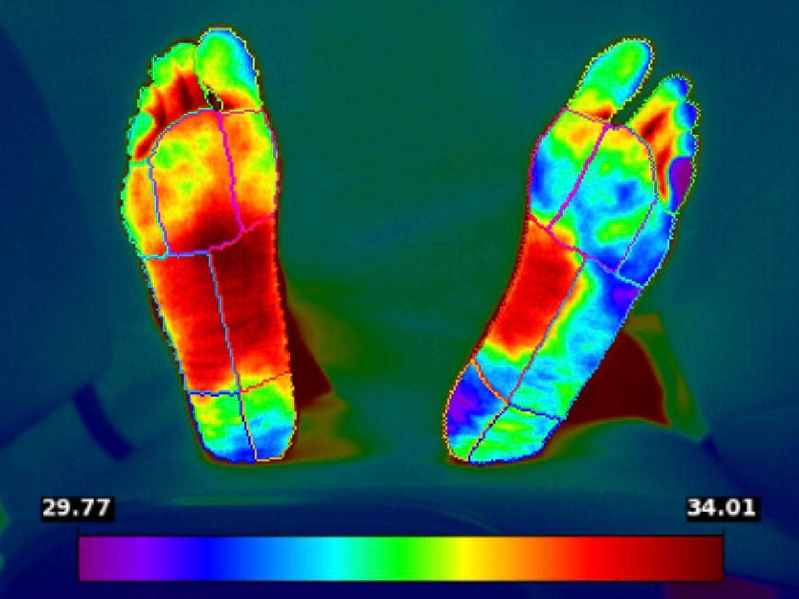 Clinicgram | Benefits of Early Detection in Diabetic Foot 